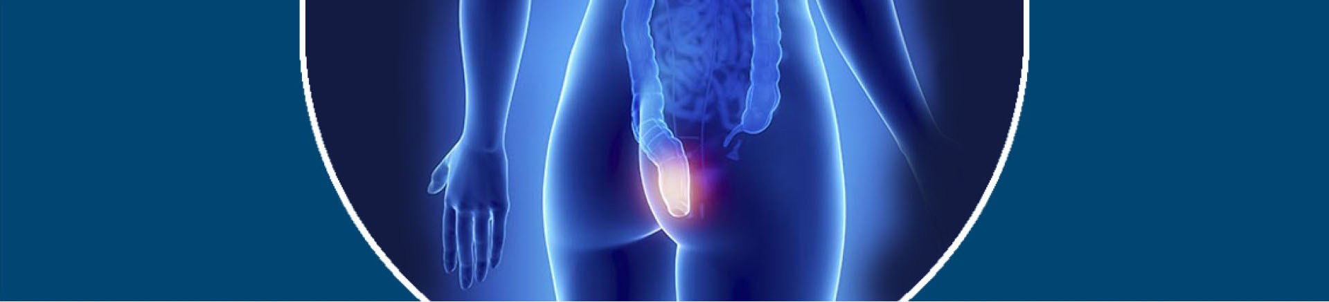 Chirurgie proctologique 